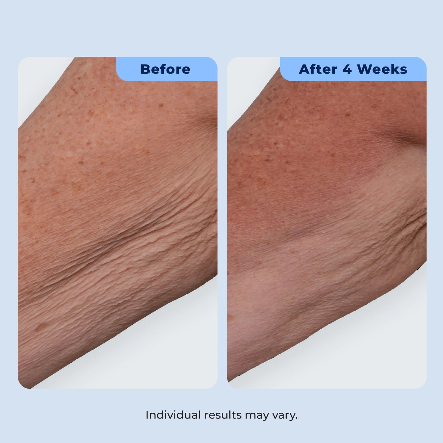 Dual Action Repair Cream