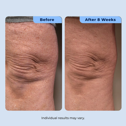 Dual Action Repair Cream